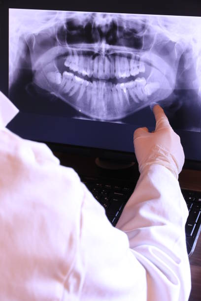 Best Emergency Wisdom Teeth Removal in Springfield, MN