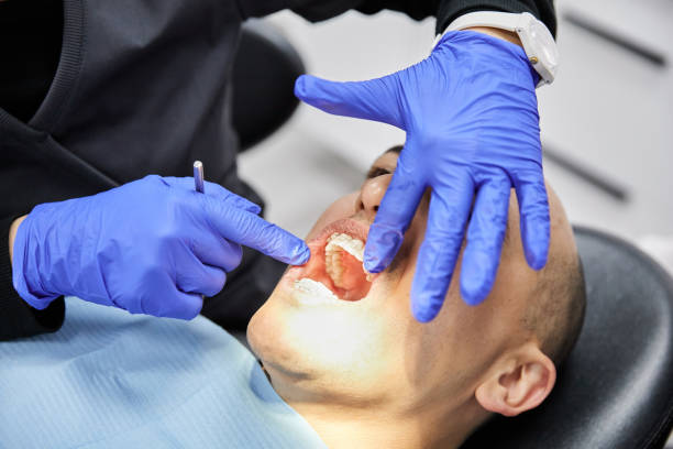 Best Emergency Treatment for Toothache in Springfield, MN